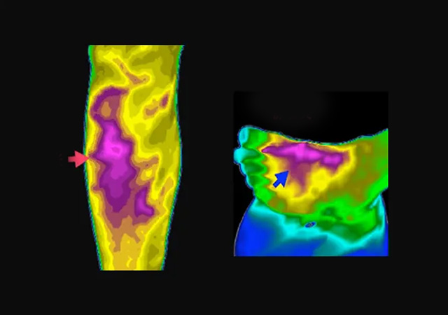 Advantages of Infrared Technology in the Medical Field