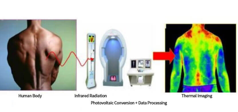 Infrared Thermal Imaging in Medical Diagnosis