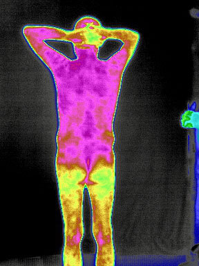 Infrared Thermal Imaging in Medical Diagnosis